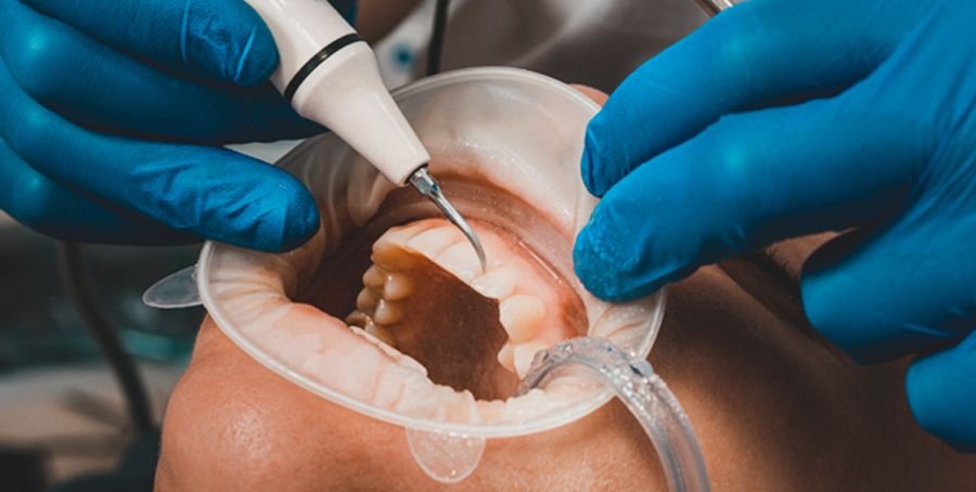 Periodontal Treatment